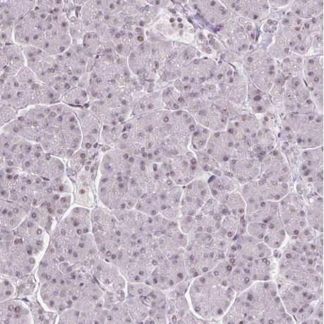 Immunohistochemistry (Formalin/PFA-fixed paraffin-embedded sections) - Anti-TCFL5 antibody (AB188075)