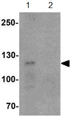 Western blot - Anti-TCIRG1 antibody (AB139812)