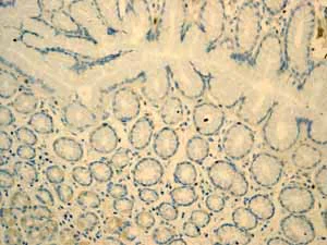 Immunohistochemistry (Formalin/PFA-fixed paraffin-embedded sections) - Anti-Tcl1 antibody [EPR3949] - BSA and Azide free (AB199188)
