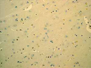 Immunohistochemistry (Formalin/PFA-fixed paraffin-embedded sections) - Anti-Tcl1 antibody [EPR3949] - BSA and Azide free (AB199188)