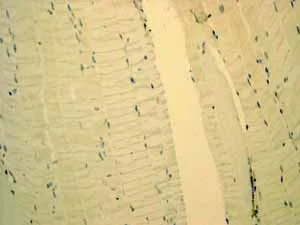 Immunohistochemistry (Formalin/PFA-fixed paraffin-embedded sections) - Anti-Tcl1 antibody [EPR3949] - BSA and Azide free (AB199188)
