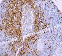 Immunohistochemistry (Formalin/PFA-fixed paraffin-embedded sections) - Anti-Tcl1 antibody [EPR3949] - BSA and Azide free (AB199188)