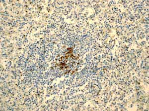 Immunohistochemistry (Formalin/PFA-fixed paraffin-embedded sections) - Anti-Tcl1 antibody [EPR3949] - BSA and Azide free (AB199188)
