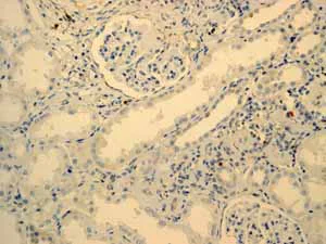 Immunohistochemistry (Formalin/PFA-fixed paraffin-embedded sections) - Anti-Tcl1 antibody [EPR3949] - BSA and Azide free (AB199188)