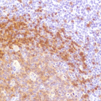 Immunohistochemistry (Formalin/PFA-fixed paraffin-embedded sections) - Anti-Tcl1 antibody [SP248] - BSA and Azide free (AB242426)