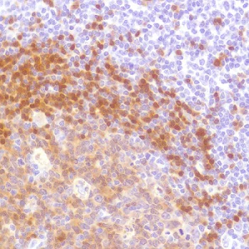 Immunohistochemistry (Formalin/PFA-fixed paraffin-embedded sections) - Anti-Tcl1 antibody [SP248] - BSA and Azide free (AB242426)
