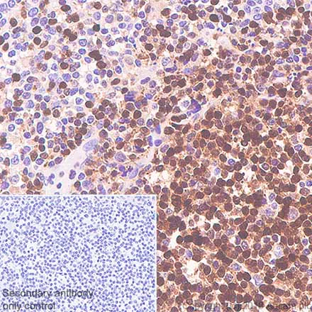 Immunohistochemistry (Formalin/PFA-fixed paraffin-embedded sections) - Anti-Tcl1 antibody [SP248] - BSA and Azide free (AB242426)