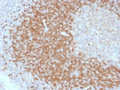 Immunohistochemistry (Formalin/PFA-fixed paraffin-embedded sections) - Anti-Tcl1 antibody [TCL1/2078] (AB238077)