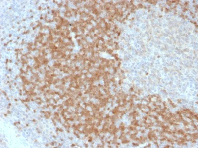 Immunohistochemistry (Formalin/PFA-fixed paraffin-embedded sections) - Anti-Tcl1 antibody [TCL1/2078] (AB238077)