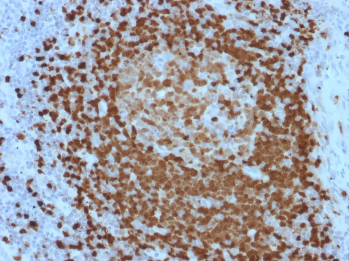 Immunohistochemistry (Formalin/PFA-fixed paraffin-embedded sections) - Anti-Tcl1 antibody [TCL1/2079] (AB268137)