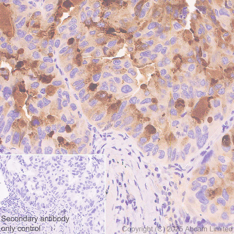 Immunohistochemistry (Formalin/PFA-fixed paraffin-embedded sections) - Anti-TCN1 antibody [EPR30835-583R] - BSA and Azide free (AB325144)