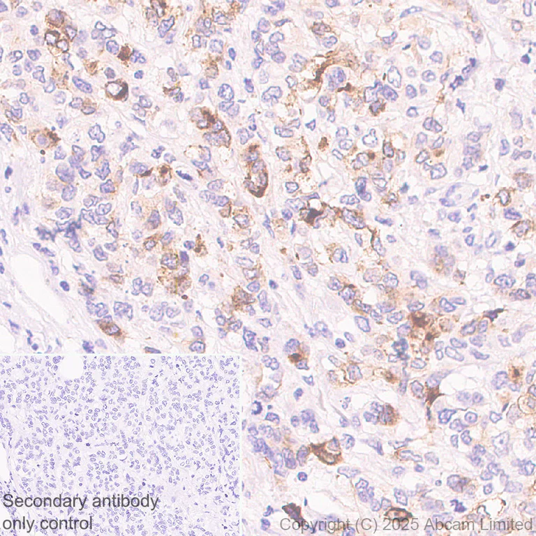 Immunohistochemistry (Formalin/PFA-fixed paraffin-embedded sections) - Anti-TCN1 antibody [EPR30835-583R] - BSA and Azide free (AB325144)