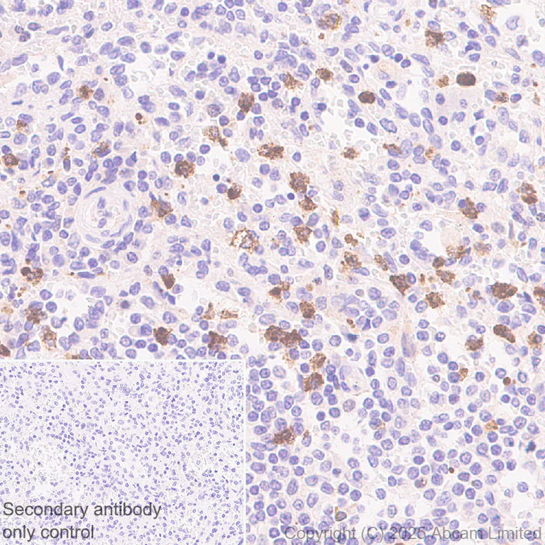 Immunohistochemistry (Formalin/PFA-fixed paraffin-embedded sections) - Anti-TCN1 antibody [EPR30835-583R] - BSA and Azide free (AB325144)