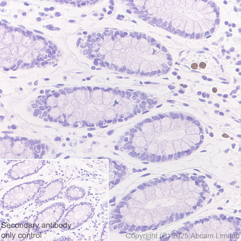 Immunohistochemistry (Formalin/PFA-fixed paraffin-embedded sections) - Anti-TCN1 antibody [EPR30835-583R] - BSA and Azide free (AB325144)