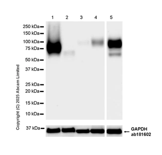 Western blot - Anti-TCN1 antibody [EPR30835-583R] - BSA and Azide free (AB325144)