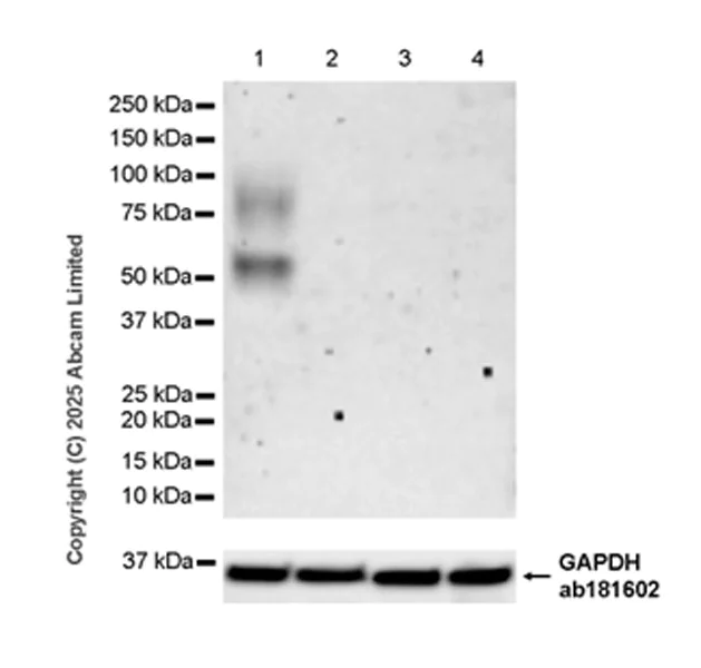 Western blot - Anti-TCN1 antibody [EPR30835-583R] - BSA and Azide free (AB325144)