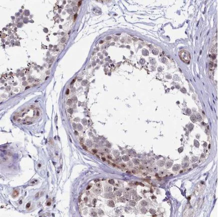 Immunohistochemistry (Formalin/PFA-fixed paraffin-embedded sections) - Anti-TCOF1 antibody (AB224544)