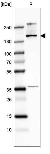 Western blot - Anti-TCOF1 antibody (AB224544)