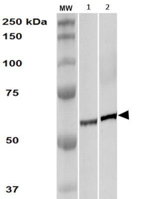 Western blot - Anti-TCP1 alpha/CCTA antibody [91a] (AB240903), expandable thumbnail