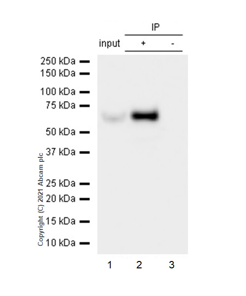 Immunoprecipitation - Anti-TCP1 alpha/CCTA antibody [EPR4081] (AB92587), expandable thumbnail