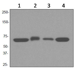 Western blot - Anti-TCP1 alpha/CCTA antibody [EPR4081] (AB92587), expandable thumbnail
