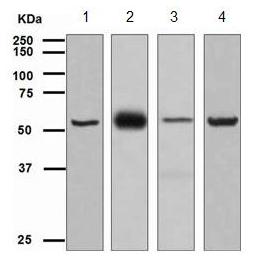 Western blot - Anti-TCP1 alpha/CCTA antibody [EPR4082] (AB109126), expandable thumbnail
