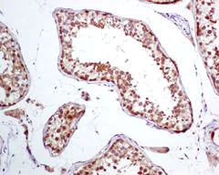 Immunohistochemistry (Formalin/PFA-fixed paraffin-embedded sections) - Anti-TCP1 alpha/CCTA antibody [EPR4082] - BSA and Azide free (AB239946)