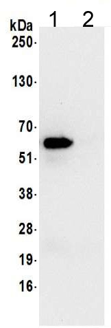 Immunoprecipitation - Anti-TCP1 delta antibody (AB205013), expandable thumbnail