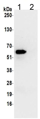 Immunoprecipitation - Anti-TCP1 delta antibody (AB205013)