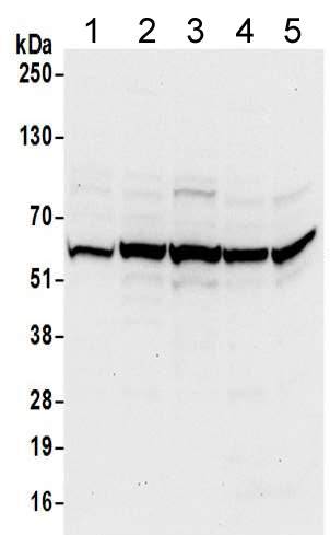 Western blot - Anti-TCP1 delta antibody (AB205013), expandable thumbnail
