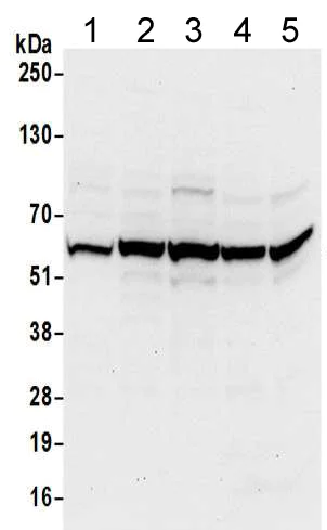 Western blot - Anti-TCP1 delta antibody (AB205013)
