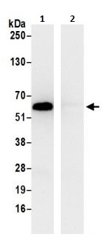 Immunoprecipitation - Anti-TCP1 delta antibody (AB264353), expandable thumbnail