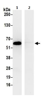 Immunoprecipitation - Anti-TCP1 delta antibody (AB264353)