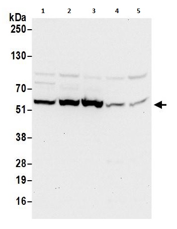 Western blot - Anti-TCP1 delta antibody (AB264353), expandable thumbnail