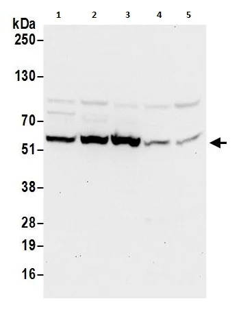 Western blot - Anti-TCP1 delta antibody (AB264353)