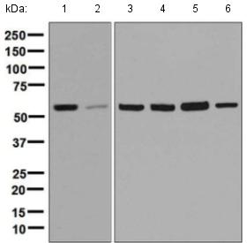 Western blot - Anti-TCP1 delta antibody [EPR8494(B)] (AB129112), expandable thumbnail