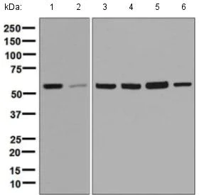 Western blot - Anti-TCP1 delta antibody [EPR8494(B)] (AB129112)