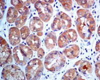 Immunohistochemistry (Formalin/PFA-fixed paraffin-embedded sections) - Anti-TCP1 delta antibody [EPR8495(B)] (AB129072)