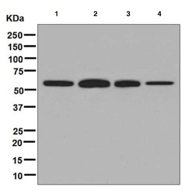 Western blot - Anti-TCP1 delta antibody [EPR8495(B)] - BSA and Azide free (AB248280), expandable thumbnail