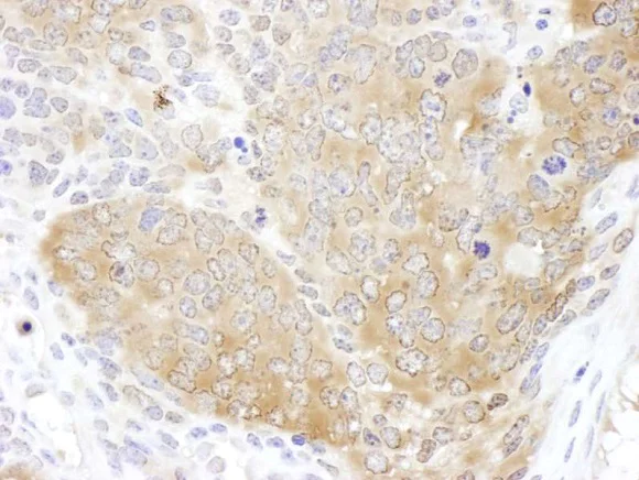 Immunohistochemistry (Formalin/PFA-fixed paraffin-embedded sections) - Anti-TCP1 epsilon/CCT5 antibody (AB225876)