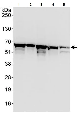 Western blot - Anti-TCP1 epsilon/CCT5 antibody (AB225876)