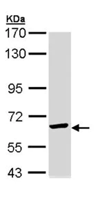 Western blot - Anti-TCP1 epsilon/CCT5 antibody (AB96344)