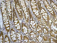 Immunohistochemistry (Formalin/PFA-fixed paraffin-embedded sections) - Anti-TCP1 epsilon/CCT5 antibody [EPR7562] (AB129016)