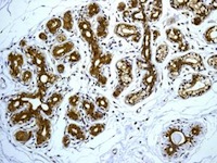 Immunohistochemistry (Formalin/PFA-fixed paraffin-embedded sections) - Anti-TCP1 epsilon/CCT5 antibody [EPR7562] - BSA and Azide free (AB248261), expandable thumbnail