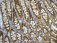 Immunohistochemistry (Formalin/PFA-fixed paraffin-embedded sections) - Anti-TCP1 epsilon/CCT5 antibody [EPR7562] - BSA and Azide free (AB248261), expandable thumbnail
