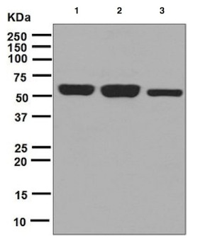 Western blot - Anti-TCP1 epsilon/CCT5 antibody [EPR7562] - BSA and Azide free (AB248261), expandable thumbnail