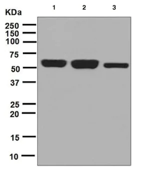 Western blot - Anti-TCP1 epsilon/CCT5 antibody [EPR7562] - BSA and Azide free (AB248261)