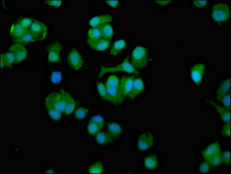 Immunocytochemistry/ Immunofluorescence - Anti-TCP1 eta antibody (AB237762)