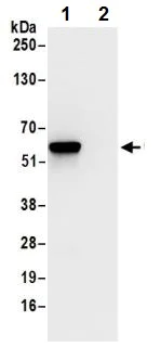 Immunoprecipitation - Anti-TCP1 eta antibody (AB240566)