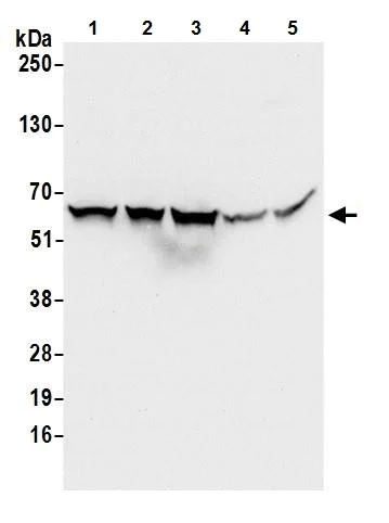 Western blot - Anti-TCP1 eta antibody (AB240566)